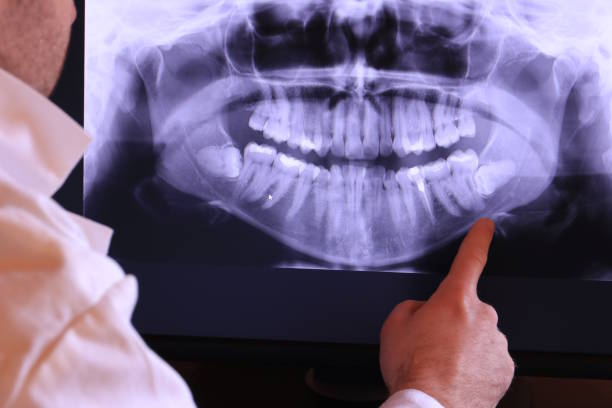 Best Emergency Denture Repair in Orange, CA