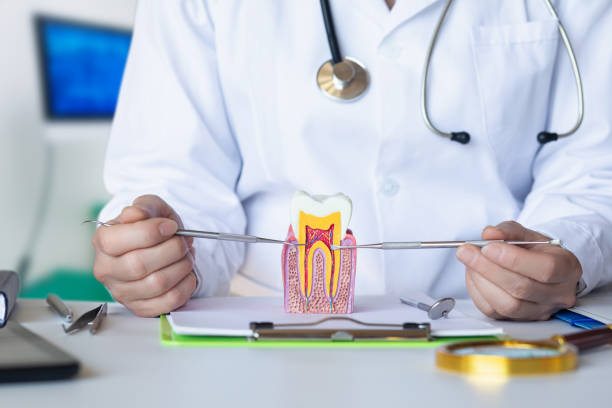 Best Dental Abscess Treatment in Orange, CA